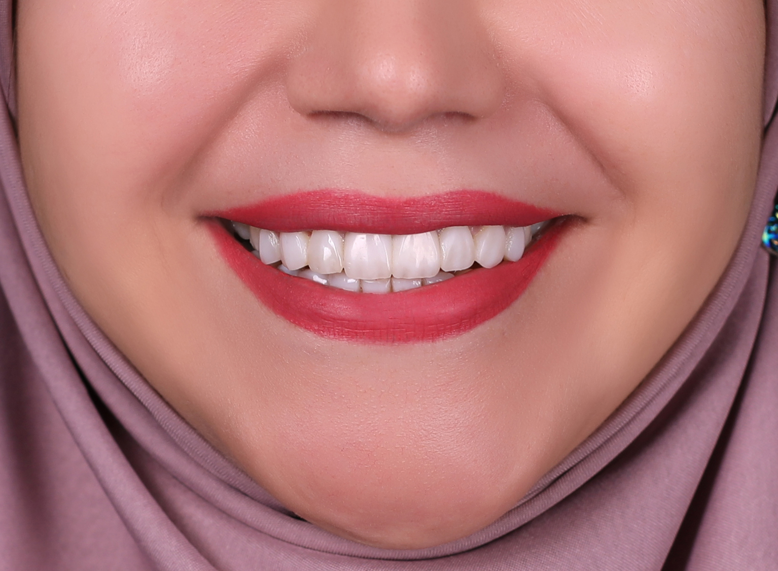 كامپوزیت 02